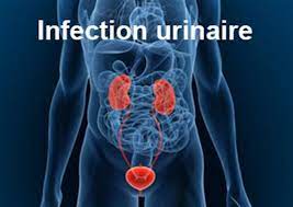 Ivuriro Kundubuzima Health LTD: Ubuvuzi bwa Urinary Infections imwe mu ndwara zifata urwungano rw’inkari